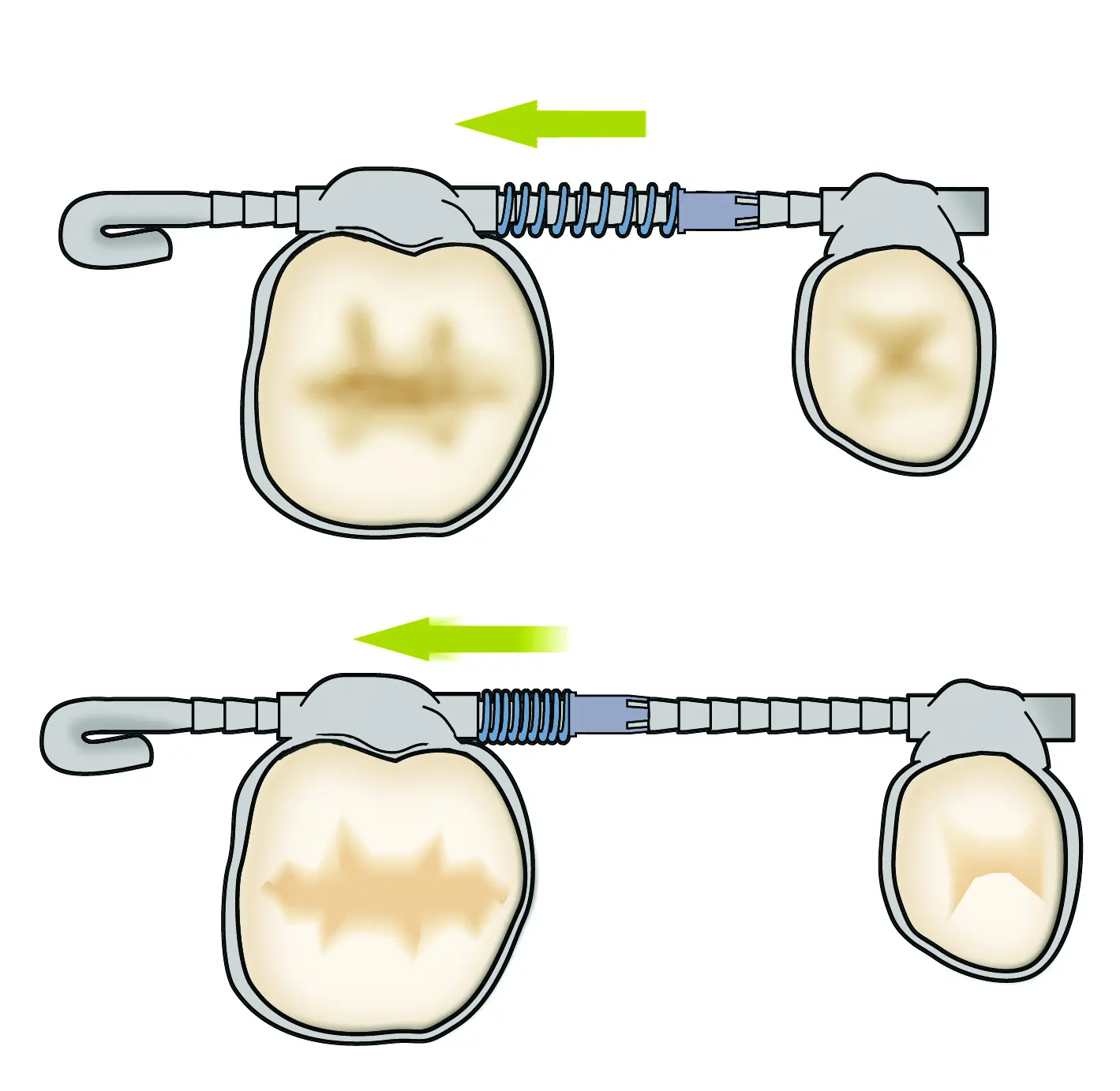 Ipc illustrationop1